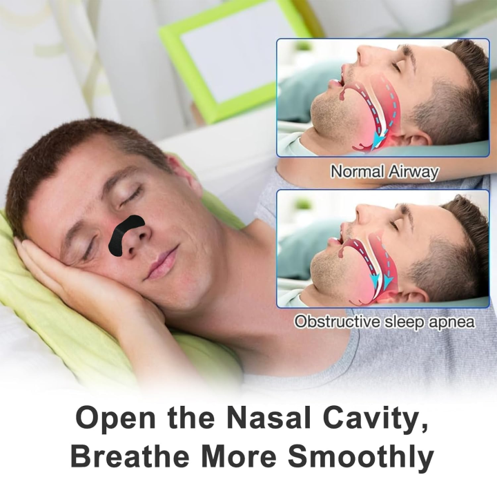 30/60/90/150%20Pieces,Anti%20Snoring%20Nose%20Strips%20for%20Breathing%20Correction%20Physical%20Expansion%20Breathable%20Nasal%20Patch%20Nasal%20Strips%20-%20Image%202