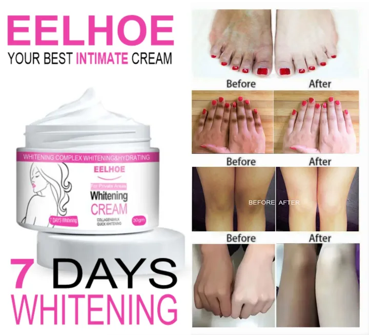 Aveessence%20Whitening%20Cream%20for%20Dark%207%20days%20Whitening%20Cream%20-%20Image%204