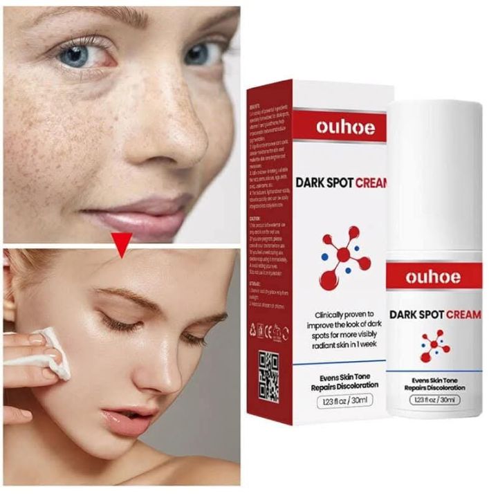 OUHOE%20Dark%20Spot%20Remover%20-%20Image%203