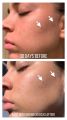 The Ordinary Niacinamide. 