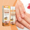 Bee Venom Nail Fungus Repair Spray Gray Nail Treatment Onychomycosis Paronychia Removal Relieve Foot Odor Hand Foot Nail Care freshfeet.