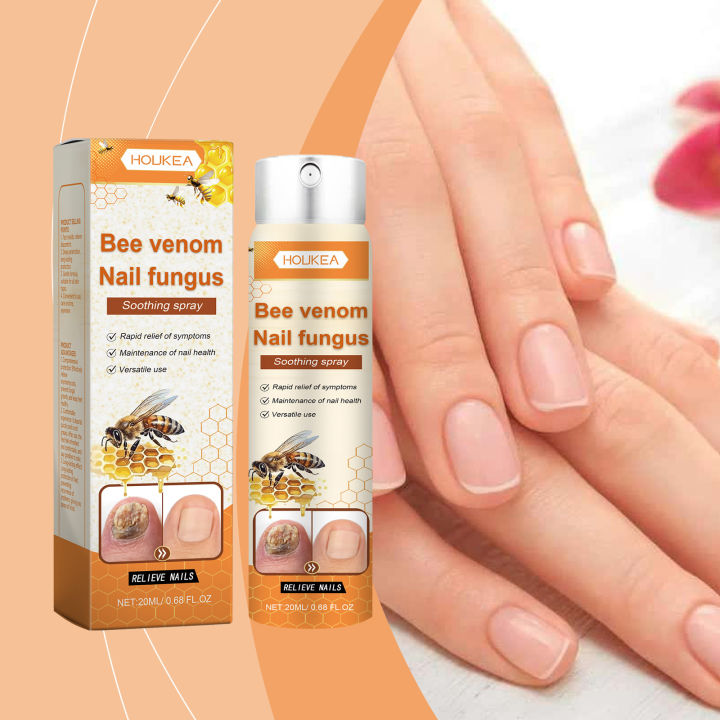 Bee%20Venom%20Nail%20Fungus%20Repair%20Spray%20Gray%20Nail%20Treatment%20Onychomycosis%20Paronychia%20Removal%20Relieve%20Foot%20Odor%20Hand%20Foot%20Nail%20Care%20freshfeet%20-%20Image%203