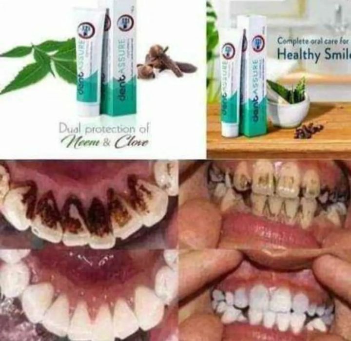 Dent%20Assure%20Toothpaste%20Neem,%20Cloves%20&%20Calcium%20Enriched%20100g%20India%20-%20Image%203