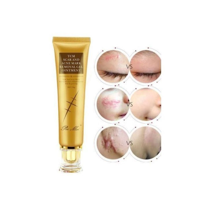 Pei%20Mei%20Tcm%20Scar%20And%20Acne%20Mark%20Removal%20Gel%20Ointment%2030%20Ml%20By%20Mama%20Bhanja%20-%20Image%204