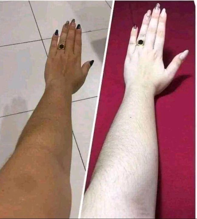 Aceso%20Full%20Face%20&%20Body%20Whitening%20Combo%20-%20Image%204