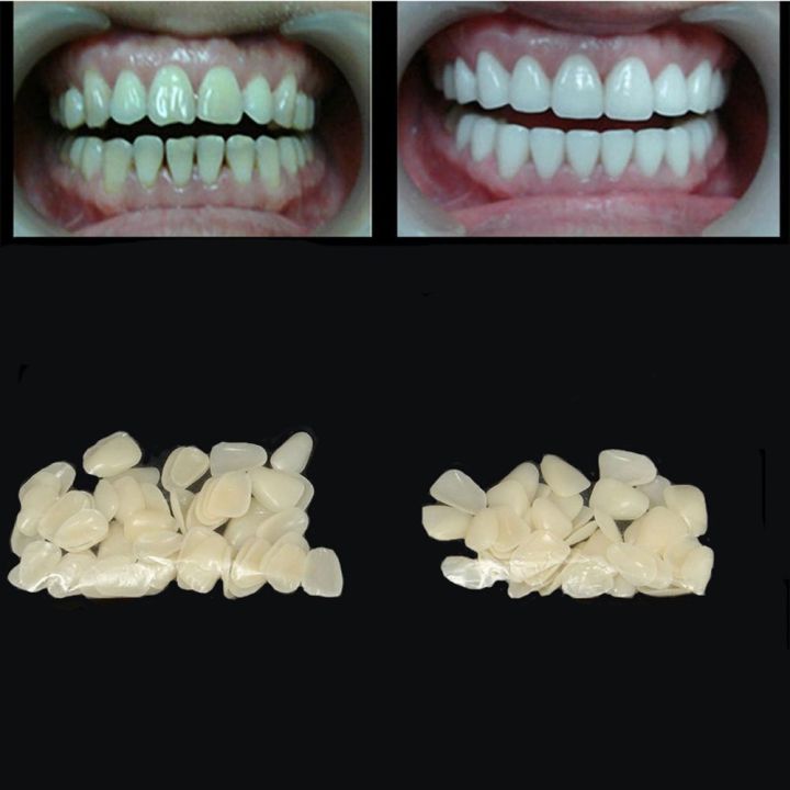 70PCS/Package Dental Ultra-Thin Veneers Resin Teeth Upper Anterior Hot
