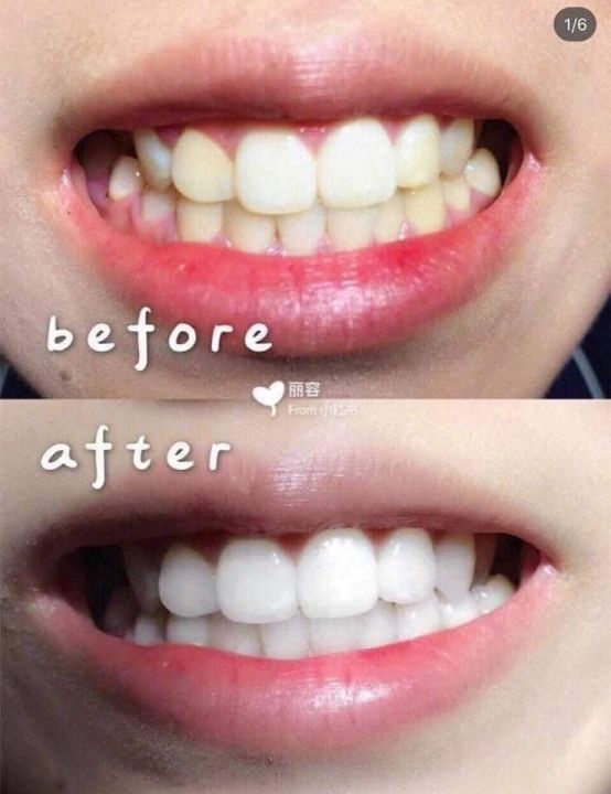 White%20&%20White%20150g%20Made%20in%20Japan%20Toothpaste%20*100%25%20Authentic%20-%20Image%203