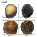 Authentic Dexe Hair Building Fiber 22g. 