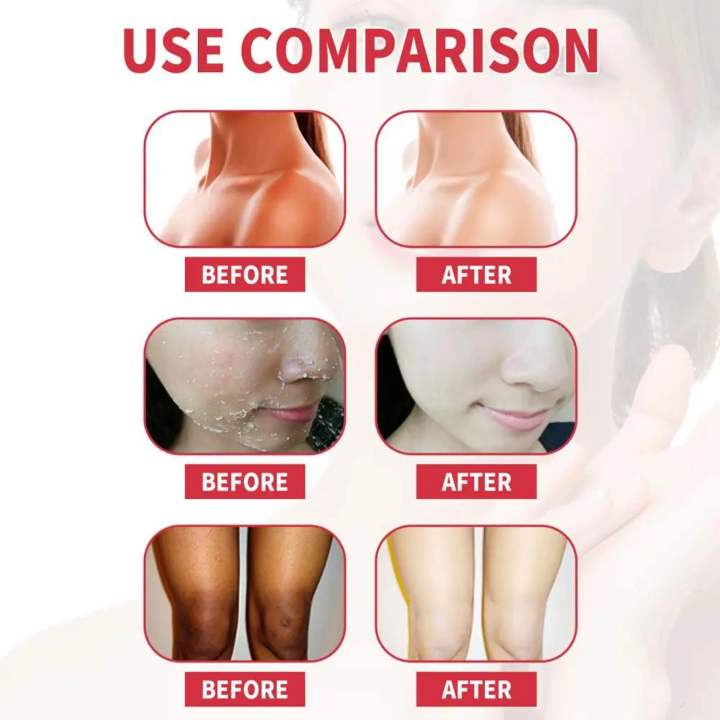 Heyxi%20Peach%20Body%20Scrub%20200%20Ml%20Exfoliating%20Shower%20Scrub%20for%20Smooth%20Skin%20Bath%20And%20Body%20Care%20-%20Image%208