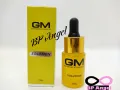 GM quick-release solution. 