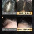 Hair Serum Bai Hei Ke. 