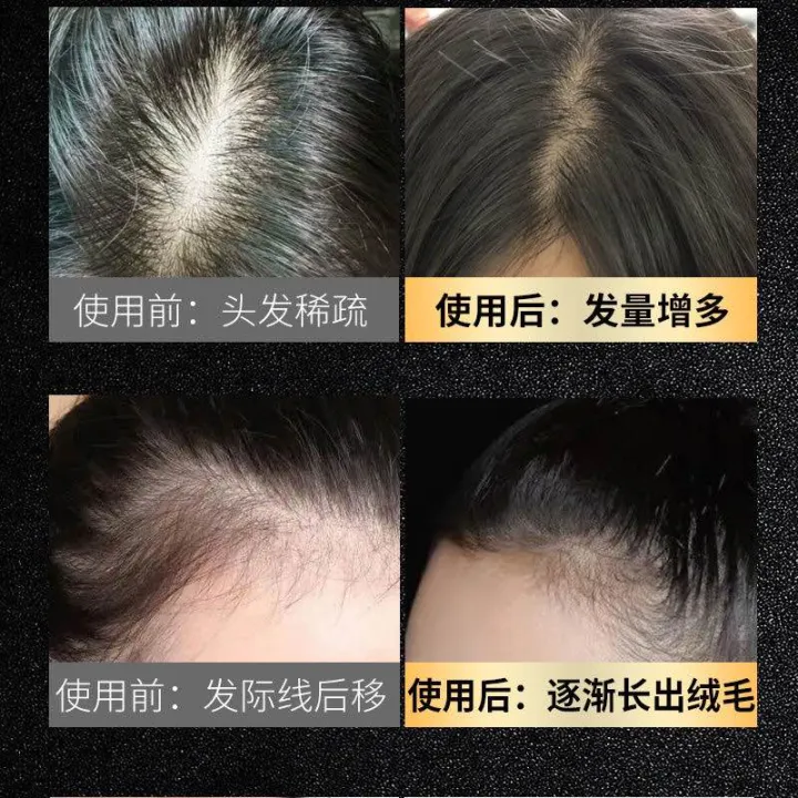 Hair%20Serum%20Bai%20Hei%20Ke%20-%20Image%206