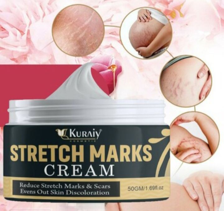 Stretch Marks Cream - Effective Skin Care for Stretch Marks