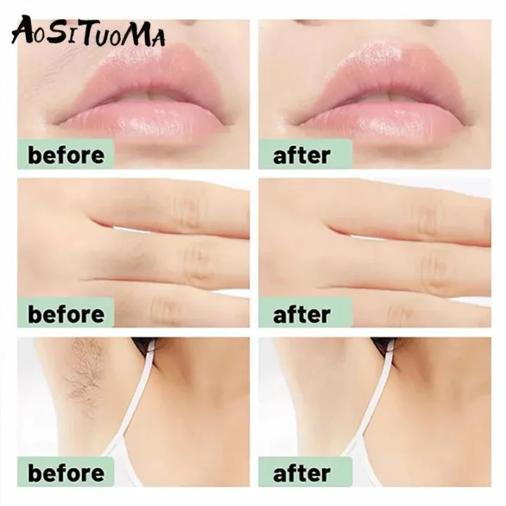 Facial%20Wax%20Strips,%20Facial%20Hair%20Removal,%20Quick%20and%20Painless%20Hair%20Removal%20Kit,%20for%20All%20Skin%20Types,%2010%20Pieces%20-%20Image%205