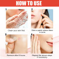 144pcs/set Face Skin Care Acne Pimple Patch Invisible Professional Healing Absorbing Spot Sticker Covering Acne for Men Women. 