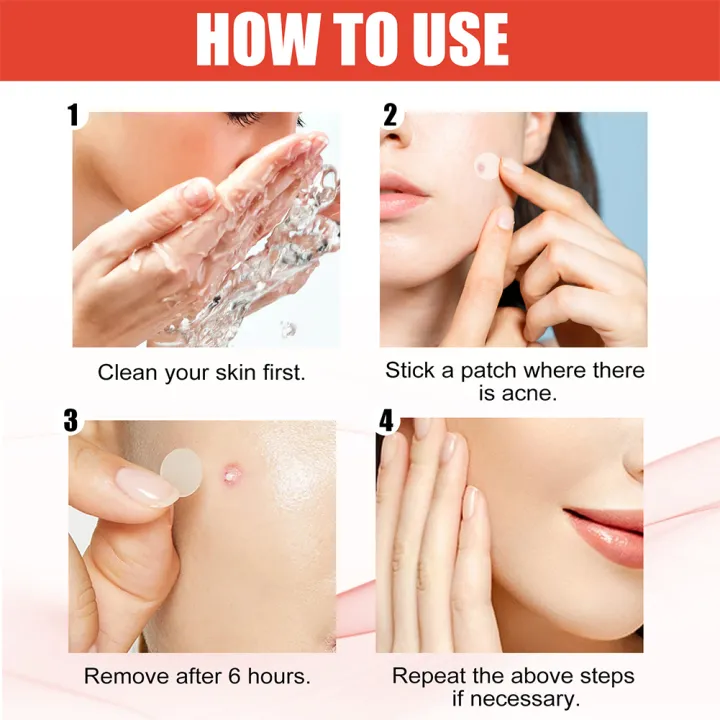 144pcs/set%20Face%20Skin%20Care%20Acne%20Pimple%20Patch%20Invisible%20Professional%20Healing%20Absorbing%20Spot%20Sticker%20Covering%20Acne%20for%20Men%20Women%20-%20Image%205