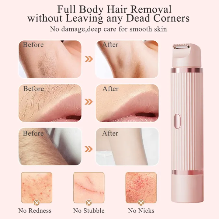Electric%20Razor%20for%20Woman%20Bikini%20Trimmer%20Body%20Epilator%20Women%20Electric%20Shaver%20for%20Private%20Area%20Underarm%20Legs%20Facial%20Hair%20Removal%20-%20Image%206