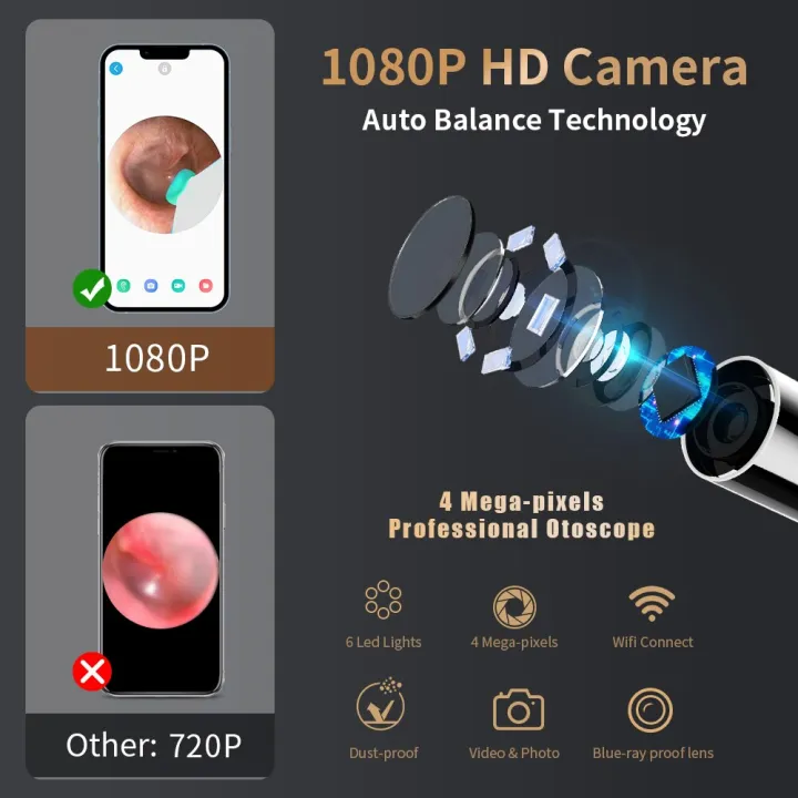 Wireless%20Visual%20Ear%20Wax%20Removal%20Safe%20Endoscope%20Earpick%20with%20Camera%201080P%20Luminous%20Otoscope%20Ear%20Cleaning%20Tools%20-%20Image%202