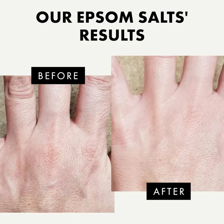 Epsom%20Bath%20Salts%20700gm%20-%20100%25%20Epsom%20Salt%20-%20Pure%20Magnesium%20Bath%20Salts%20with%20Eucalyptus%20Oil%20&%20Vitamin%20E%20-%20Epsom%20Salts%20for%20Bath,%20Epsom%20Salts%20for%20Feet%20-%20Bath%20Salts%20Muscle%20Soak%20-%20Image%202