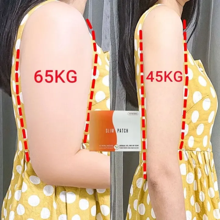 Slimming patch belly slimming hand legs slimming patch natural ...