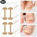 20-100pcs Adhesive Toenail Patch Ingrown Toe Nail Correction Sticker Foot Corrector Pedicure Health Care Tools Toe Treatment Pad freshfeet.