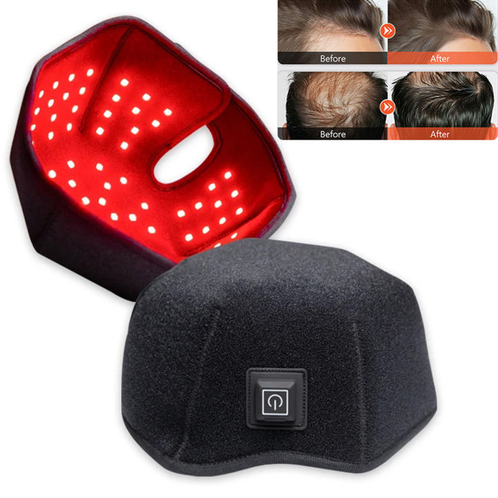 660nm%20850nm%20Red%20&%20Infrared%20Light%20Hair%20Growth%20Cap,%20USB%20Charging%20Red%20Light%20Therapy%20Device%20Hair%20Loss%20Treatment%20Hair%20Regrowth%20Helmet%20-%20Image%202