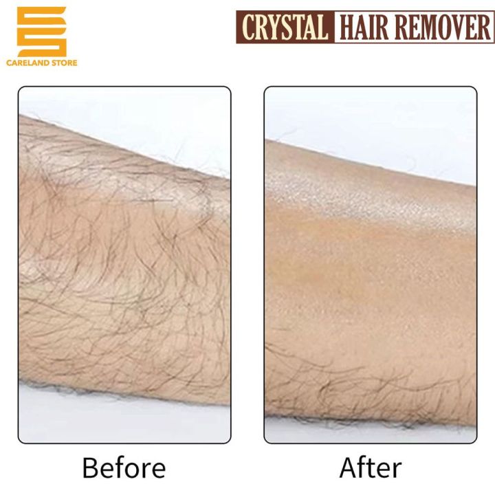 Manual%20Epilator%20for%20Men%20and%20Women%20/%20Crystal%20hair%20remover%20/%20Soap%20shaped%20trimmer%20/Painless%20shaving%20tool%20/%20Portable%20eraser%20stone%20/%20Nano%20Glass%20hair%20remover%20/%20Washable%20portable%20hair%20removal%20/%20pianless%20hair%20removal%20beauty%20tool%20-%20Image%205