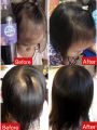 Achiherb Children's Shampoo Accelerates Hair Growth and Makes It Black. Achiherb Can Be Used by All Ages. Newborns - Adults Hair Loss after Giving Birth Is Good for Use.. 