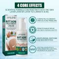 Body Lightening Cream Brighten Dull Fade Pimples Moisturize Lotion Butt Inner Thigh Brightening Serum Buttock Smooth Care Gift. 