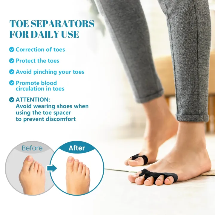 Toe%20Separators%20Doctor%20Recommended%20Correct%20Foot%20and%20Bunion%20Pain,Plantar%20Fasciitis%20Toe%20Straightener%20to%20Improve%20Functional%20Mobility%20-%20Image%205