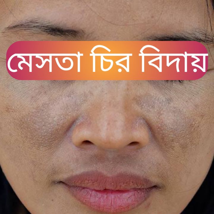 Mesta%20cream%20(30%20GM)%20-%20Image%202