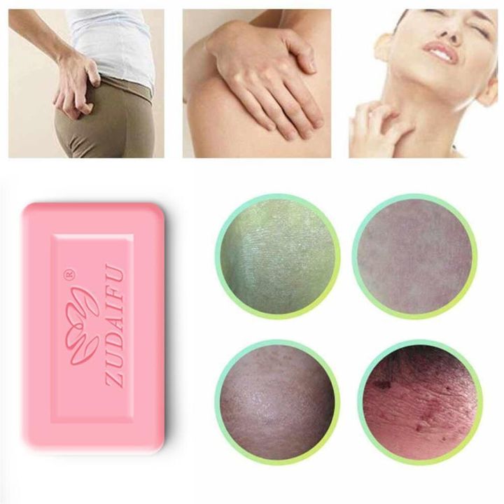 Zudaifu%20sulfur%20soap%2080g%20100%25%20genuine%20zudaifu%20sulfur%20soap%20natural%20herbal%20soap%20sulfur%20skin%20care%20soap%20body%20wash%20acne%20care%20soap%20whitening%20natural%20wash%20bath%20-%20Image%203