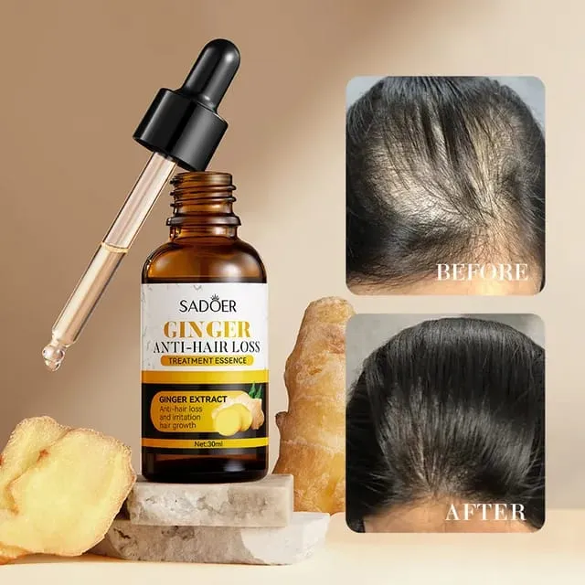 SADOER%C2%AE%EF%B8%8F%0Aginger%20hair%20serum%20Damaged%20by%20hot%20dyeing%20Triple%20Shine%20&%20Hydrate%20Hair%20Serum%20For%20Dry%20serum%20for%20hair%20-%20Image%204