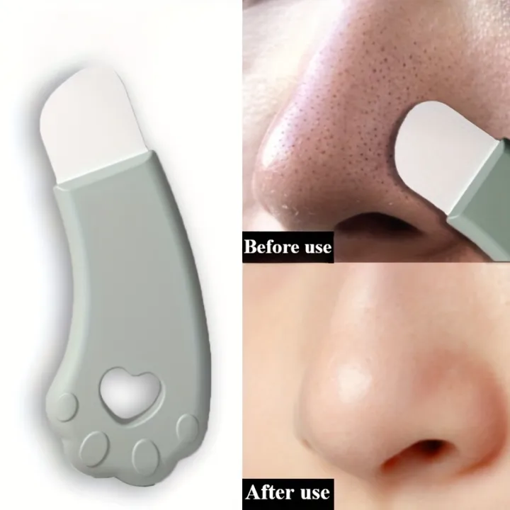 New%20Cat's%20Paw%20Blackhead%20Removal%20Tool%20-%20Perfect%20for%20Removing%20Pimples%20and%20Blemishes,%20Gentle%20Pore%20Cleansing,%20Exfoliating,%20Easy%20to%20H%20-%20Image%205