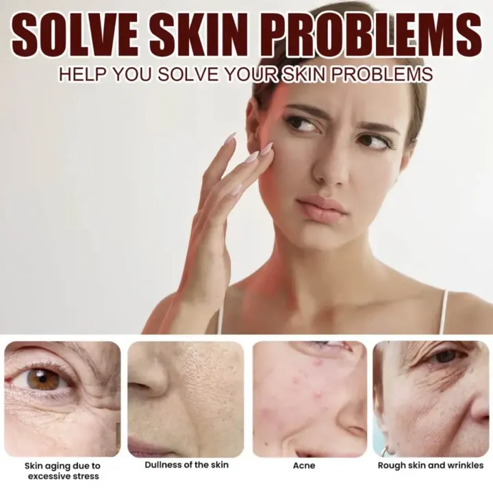 White%20Rice%20Face%20Whitening%20Cream%20Remove%20Dark%20Spots%20Fade%20Freckle%20Melanin%20Anti%20Wrinkle%20Aging%20Moisturizing%20Brighten%20Skin%20Care%20-%20Image%205