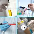 Culture Test Tube 20x150mm ( 35mL ) Autoclavable Borosilicate Glass Lab Sample Tube with Black Phenolic Screw Cap Pack of 3 5 10 25 50 & 100 Pcs for Laboratory Scientific Research Educational Biology Chemistry Home Use High Quality Durable Heat Resistant. 