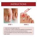 German ToenailPlus™ Anti Paronychia Relief Oil - 10ML.