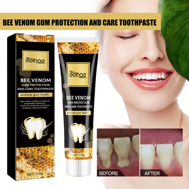 Gum%20Repair%20Toothpaste%20Plaque%20Caries%20Removal%20Protect%20Gingiva%20Treat%20Bad%20Breath%20Fade%20Tooth%20Stain%20Deep%20Clean%20Brightening%20Toothpaste%20-%20Image%202