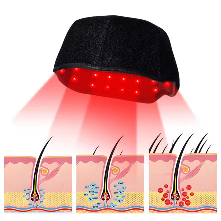 660nm%20850nm%20Red%20&%20Infrared%20Light%20Hair%20Growth%20Cap,%20USB%20Charging%20Red%20Light%20Therapy%20Device%20Hair%20Loss%20Treatment%20Hair%20Regrowth%20Helmet%20-%20Image%203
