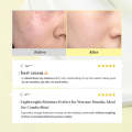 Dr. Althea 345 Relief Cream 50ml By BlissCart. 