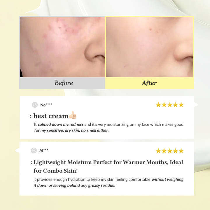 Dr.%20Althea%20345%20Relief%20Cream%2050ml%20By%20BlissCart%20-%20Image%204