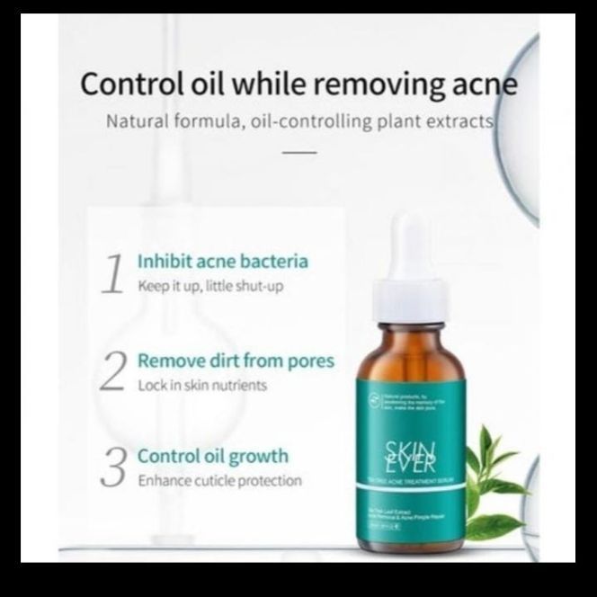 Private%20label%2030ml%20Tea%20tree%20acne%20essence%20is%20a%20pure%20natural%20tea%20tree%20extract%20that%20improves%20skin%20condition%20and%20heals%20the%20skin.%20-%20Image%203