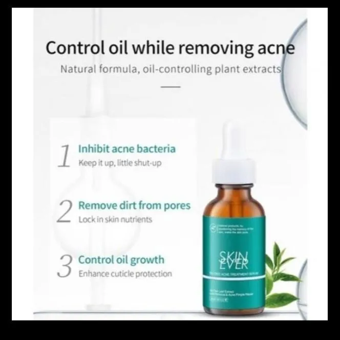 Private%20label%2030ml%20Tea%20tree%20acne%20essence%20is%20a%20pure%20natural%20tea%20tree%20extract%20that%20improves%20skin%20condition%20and%20heals%20the%20skin.%20-%20Image%203