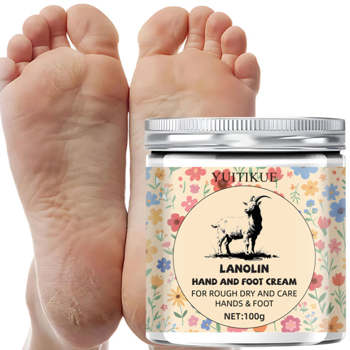 YUITIKUE%20Lanolin%20Hand%20and%20Foot%20Cream,%20suitable%20for%20rough,%20dry%20skin%20and%20for%20long-lasting%20moisturizing%20care%20of%20hands%20and%20feet.%20freshfeet%20-%20Image%202