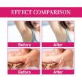 Kojic Acid and Collagen Underarm Cream 50ml - Original Genuine Product with No Side Effects. 
