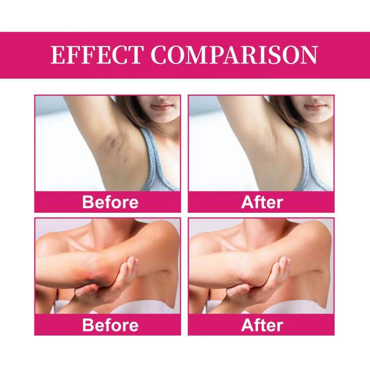 Kojic%20Acid%20and%20Collagen%20Underarm%20Cream%2050ml%20-%20Original%20Genuine%20Product%20with%20No%20Side%20Effects%20-%20Image%206