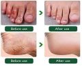 Baby Foot Banana Milk Cracked Heel Cream -80 gm. 