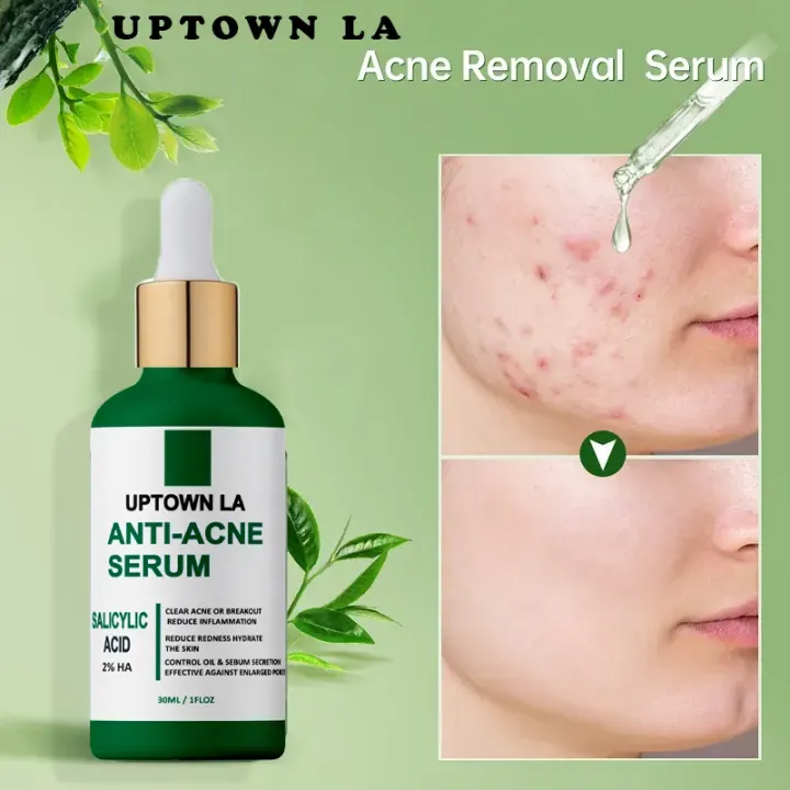 ORANGLES UPTOWN LA Anti Acne serum with Salicylic Acid for oil Control and acne removal 30 ml - high resolution display - exposing craftsmanship - Image 2 of 3 | built for everyone | UPTOWN LA Anti Acne serum with Salicylic Acid for oil Control and acne removal 30 ml for sale Georgia | Free Shipping ORANGLES