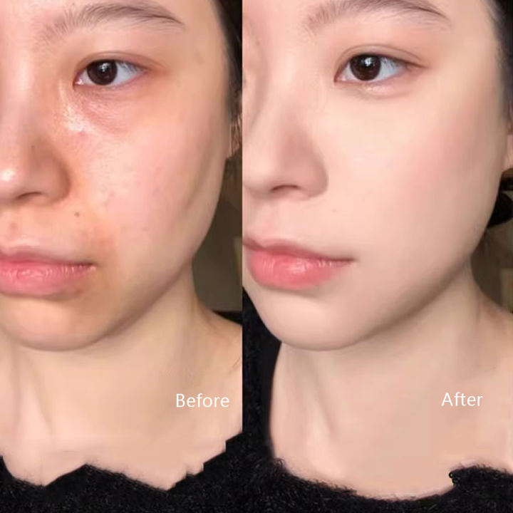 9-Color%20Flawless%20Concealer%20Palette%20-%20Waterproof,%20Sweatproof,%20Full%20Coverage%20-%20Corrects%20Spots,%20Acne,%20Dark%20Circles,%20Tear%20Grooves%20-%20-%20Image%204