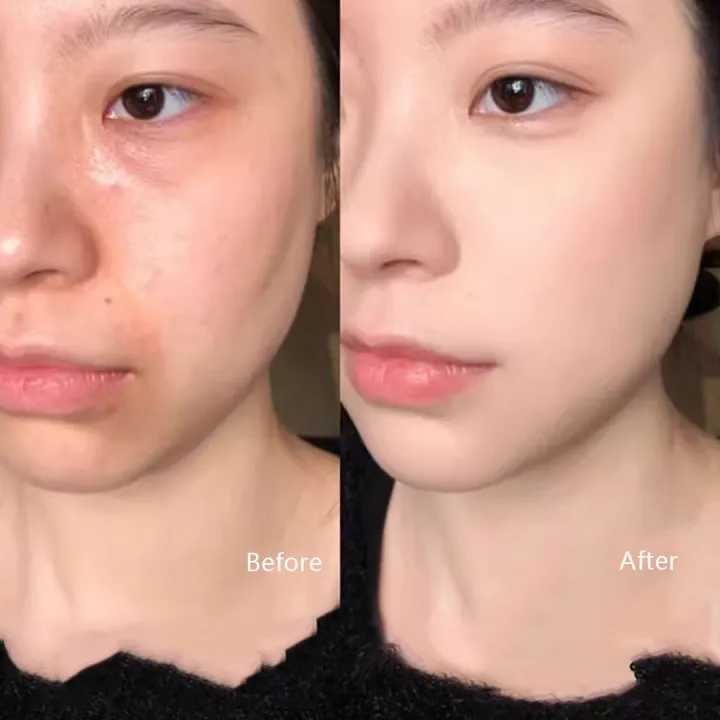 9-Color%20Flawless%20Concealer%20Palette%20-%20Waterproof,%20Sweatproof,%20Full%20Coverage%20-%20Corrects%20Spots,%20Acne,%20Dark%20Circles,%20Tear%20Grooves%20-%20-%20Image%204